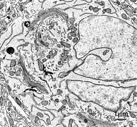 sem image analysis Biopsy Section