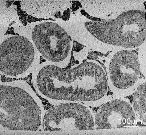 sem image analysis Biopsy Section