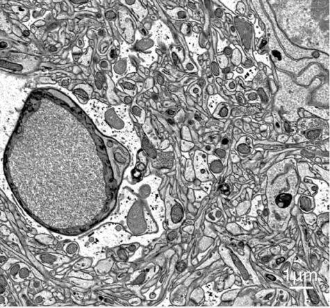 sem image analysis Biopsy Section 