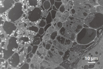 FESEM Microscope Image Plant section dark-field imaging (STEM-DF)